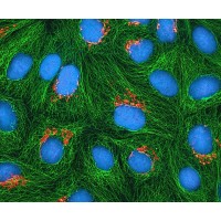 Microscopes à fluorescence